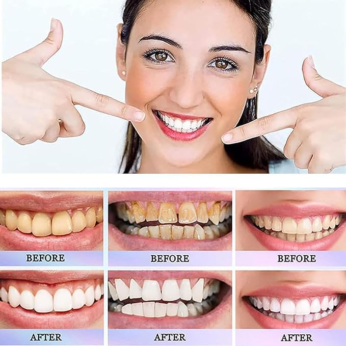 Oralhoe - Nicotinamide Dazzle White Toothpaste - Image 3