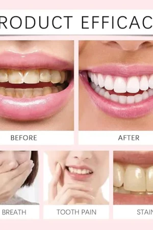 Oralhoe - Nicotinamide Dazzle White Toothpaste ksa